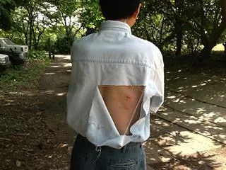 昨年フクロウに襲われシャツがカギ裂き。裂傷10ヶ所